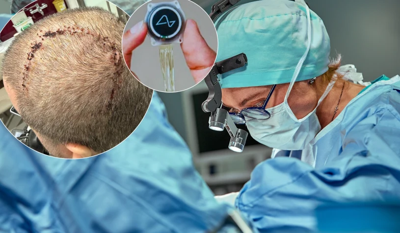 Klikanie myślami: Jak Neuralink Elona Muska przenosi granie na nowy poziom