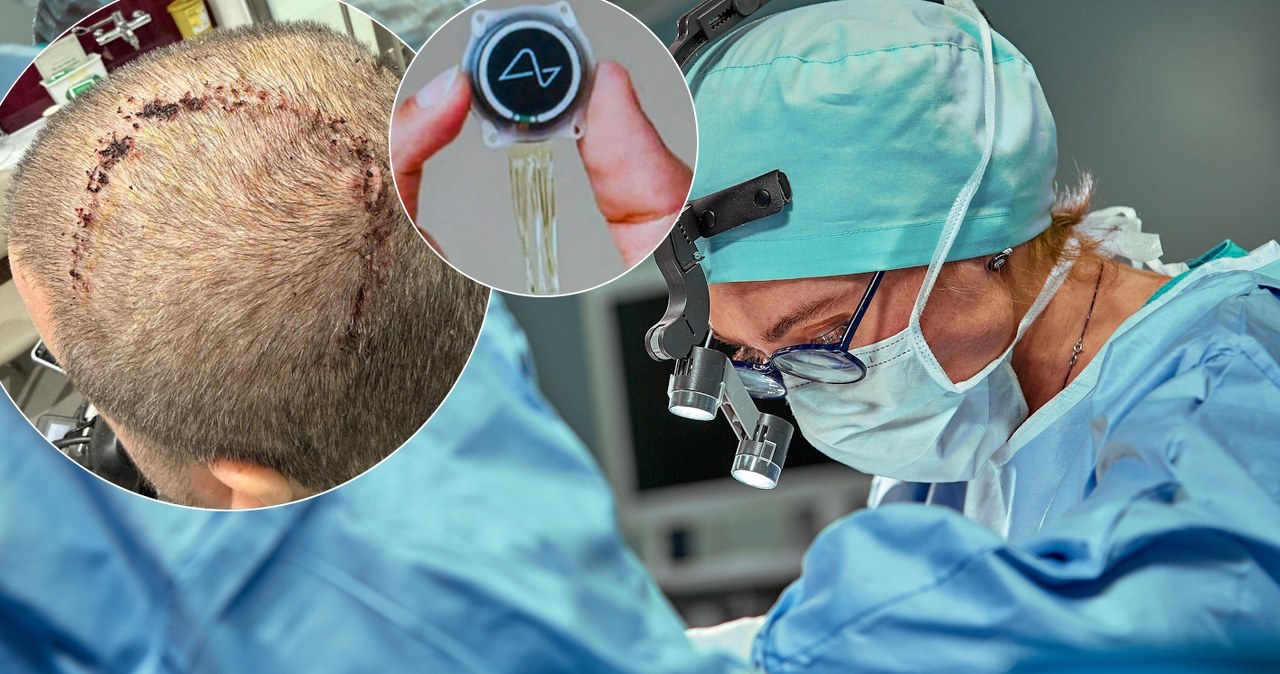 Klikanie myślami: Jak Neuralink Elona Muska przenosi granie na nowy poziom