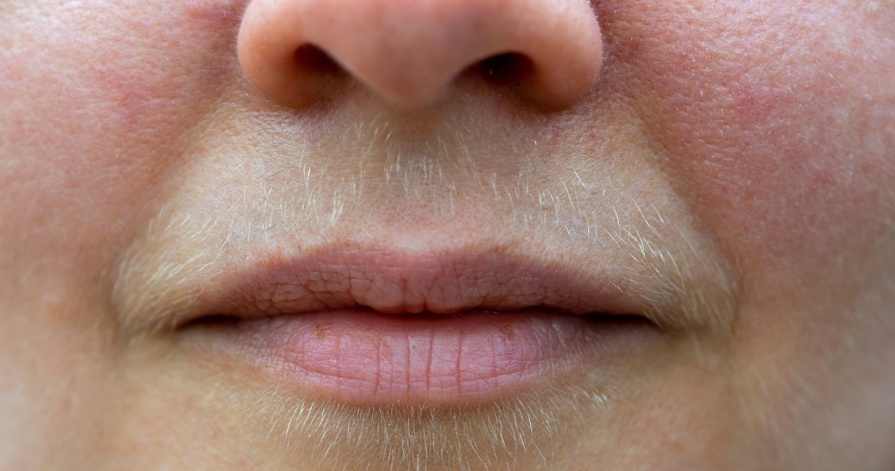 Zapomnij o depilacji. Tak usuniesz wąsik za grosze i bez wychodzenia z domu