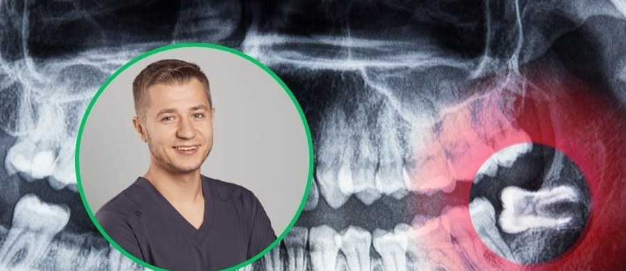 Zatrzymane zęby mądrości, czyli tzw. „ósemki”, to jeden z najczęstszych problemów, z jakimi pacjenci trafiają do chirurga stomatologicznego. Choć przez lata narosło wokół nich wiele mitów, współczesna chirurgia stomatologiczna pozwala na ich bezpieczne i co najważniejsze bezbolesne usunięcie.