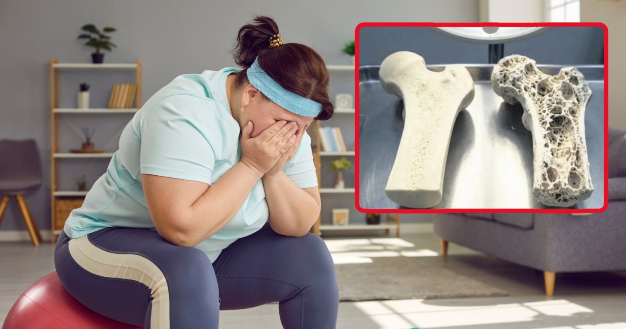 Ozempic rozpuszcza kości? Z małego badania powstał wielki mit