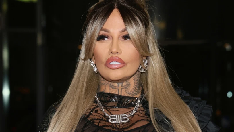 Laluna zapowiada kolejne operacje plastyczne. "Tego jest za dużo"