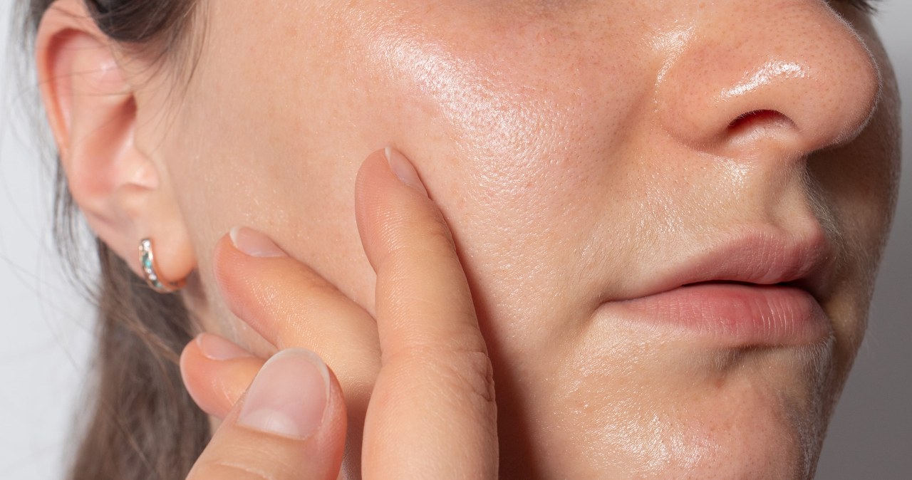 Zmniejsza widoczność porów jak laser. W aptece kosztuje kilka złotych