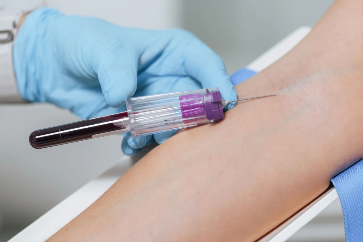 Dodatkowy dzień urlopu na badania profilaktyczne - taki pomysł zgłosiła dzisiaj grupa organizacji pacjentów i lekarzy. Według nich, zwiększyłoby to motywację, by regularnie sprawdzać swój stan zdrowia.