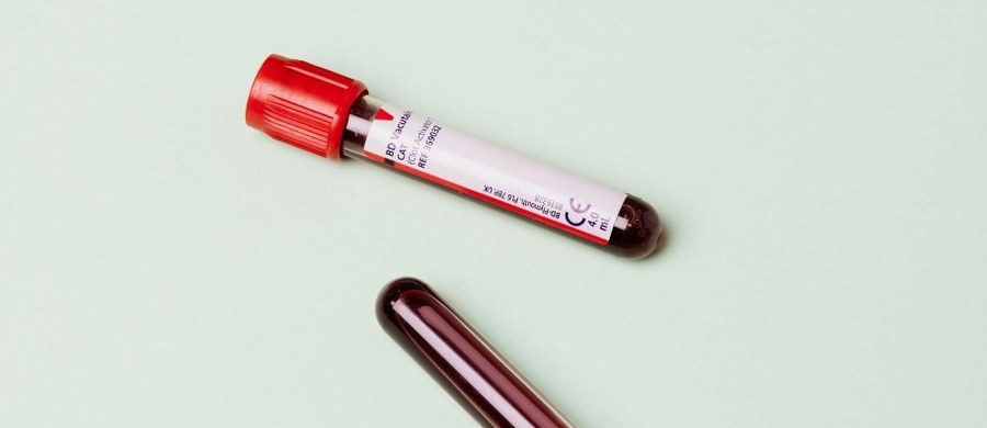 W morfologii krwi można znaleźć wiele parametrów, które pomagają zrozumieć kondycję organizmu. Jednym z nich jest P-LCR, czyli wskaźnik informujący o udziale dużych płytek krwi. Choć nie należy do podstawowych wartości analizowanych przez lekarzy, jego nieprawidłowy poziom może mieć znaczenie w ocenie ryzyka zakrzepicy czy zaburzeń pracy szpiku. Sprawdź, czym dokładnie jest P-LCR i kiedy jego wynik powinien niepokoić.