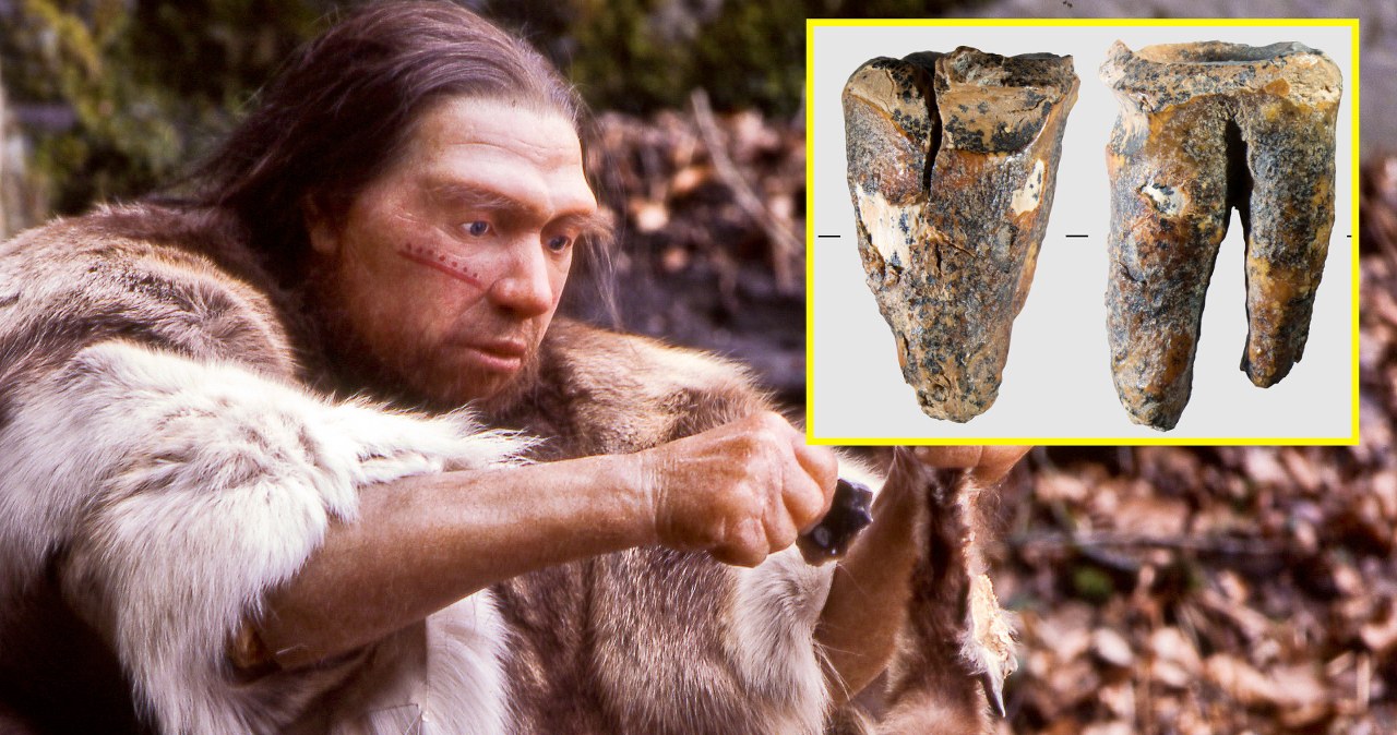 Odkryto najstarszy zabieg dentystyczny. Dokonali go Neandertalczycy