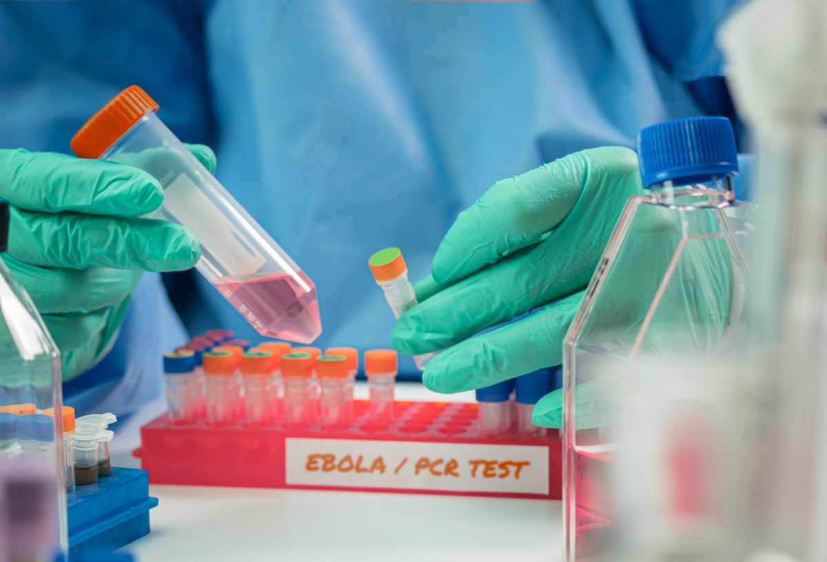 Ebola rozszerza się poza Afrykę? Podejrzenie u pacjenta w Brazylii