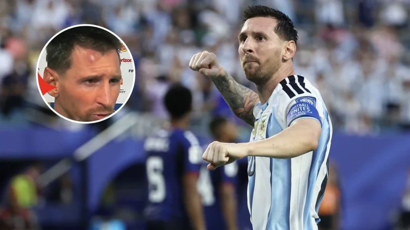 Messi appears with large bump on forehead after Argentina beat Cape Verde