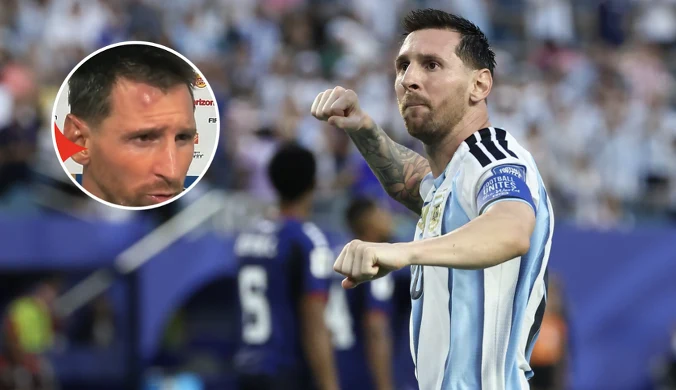 Messi nieźle oberwał. Po meczu pokazał swoją twarz. Musiało boleć