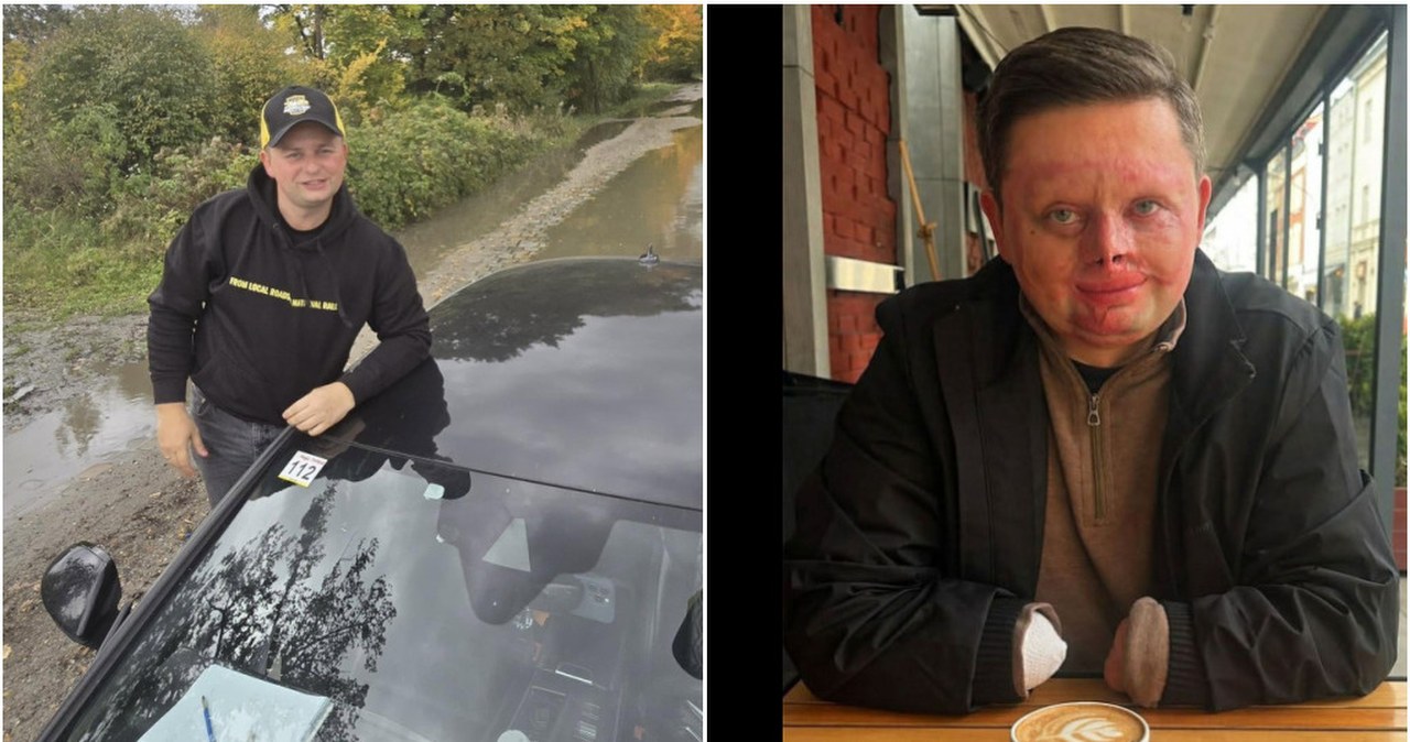 Piekło w samochodzie, było 1000 stopni. "Nie chciałem spojrzeć w lustro"