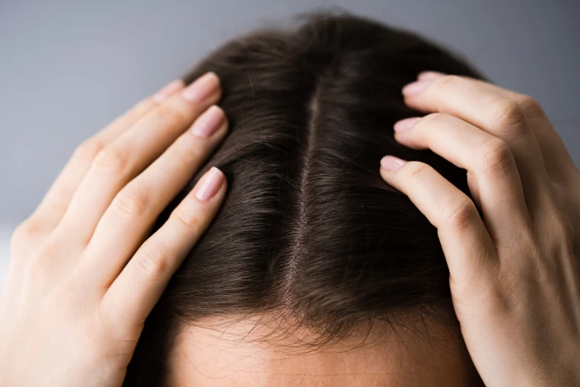 Parting and Ears: The Spots You're Missing When Applying SPF Sunscreen
