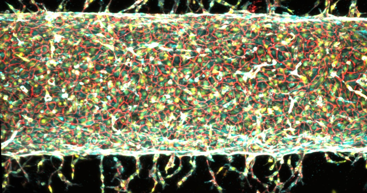 Magnesy w inżynierii biomedycznej. MIT steruje rozwojem naczyń krwionośnych