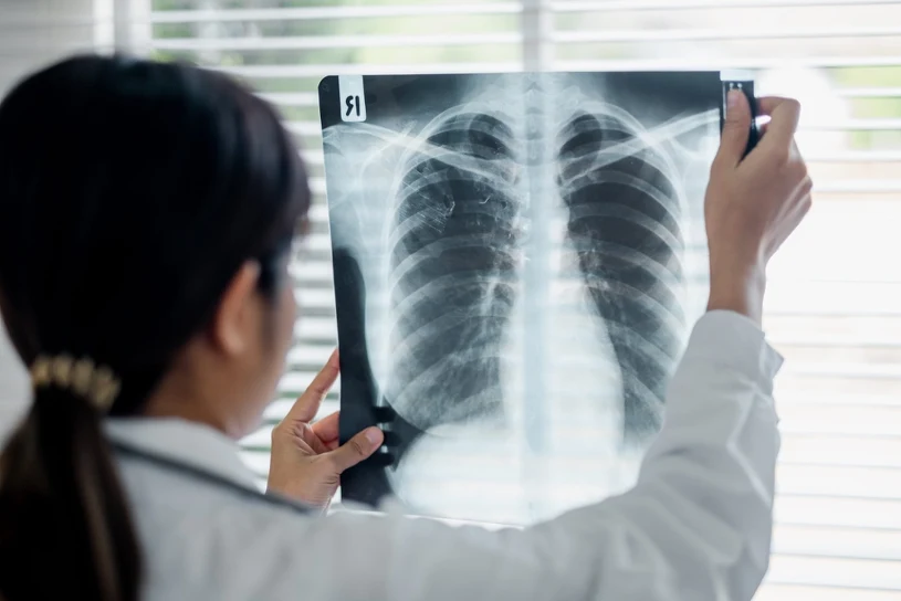 Scientists find blood metabolic changes linked to air pollution and lung cancer risk