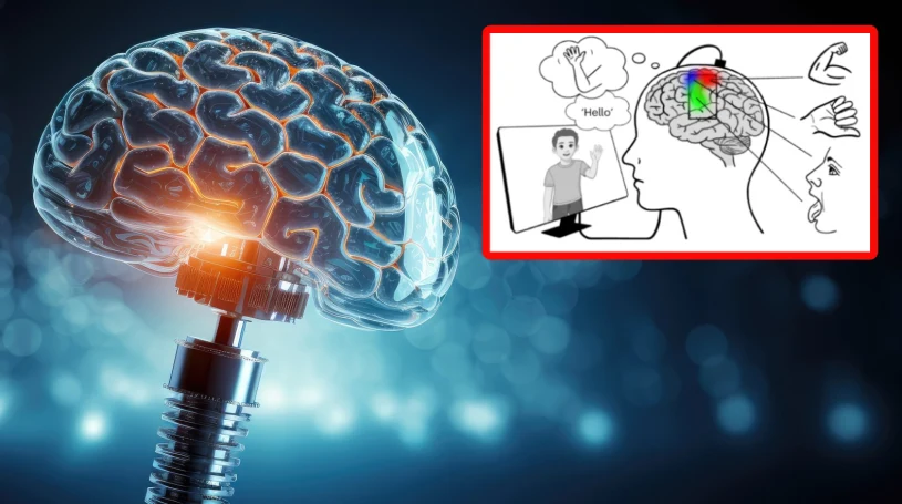 AI zmienia myśli w mowę i gesty. Pierwszy taki implant mózgowy