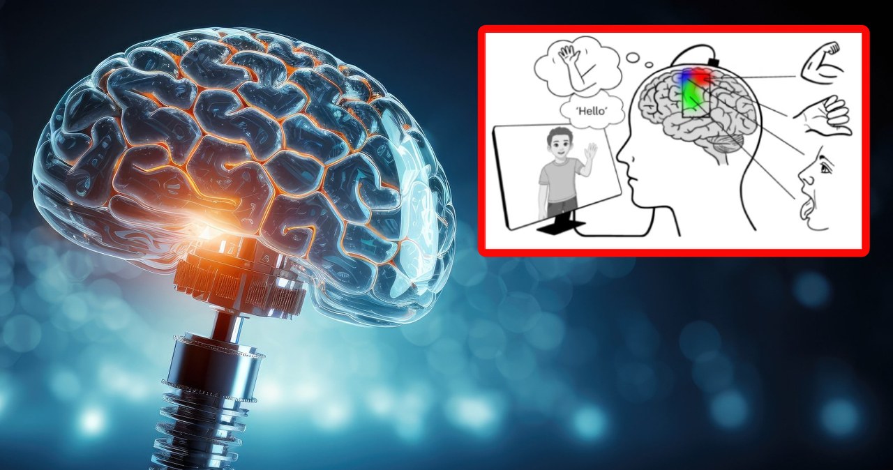 AI zmienia myśli w mowę i gesty. Pierwszy taki implant mózgowy