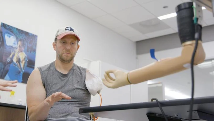 Lekarze w USA wszczepili pierwszą bioniczną rękę połączoną z kością i nerwami