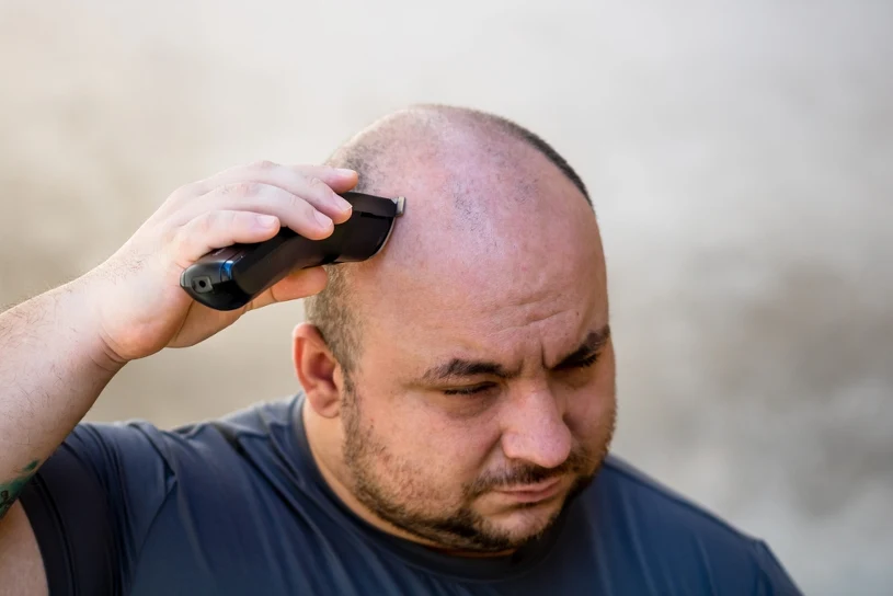 First oral hair loss therapy in 30 years shows promising Phase 3 results