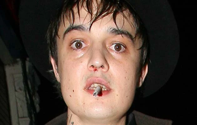 Pete Doherty Pete Doherty