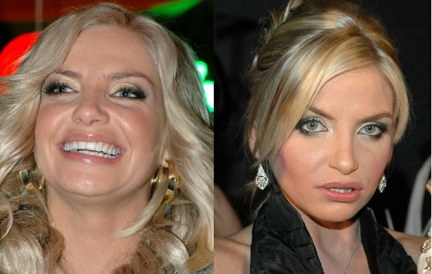 Frytak przed i po operacji. Fot. Marek Ulatowski, Andrzej Szilagyi