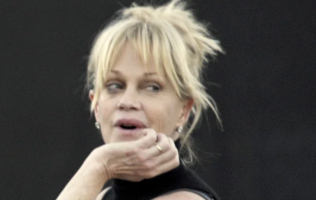 Melanie Griffith z podbitym okiem Melanie Griffith z podbitym okiem