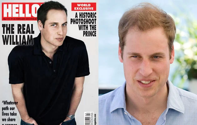 Książe William farbuje włosy? Książe William farbuje włosy?