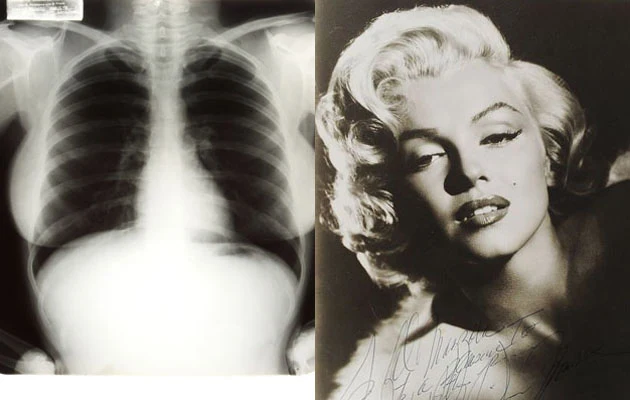 Zdjęcie rentgenowskie Marilyn Monroe
