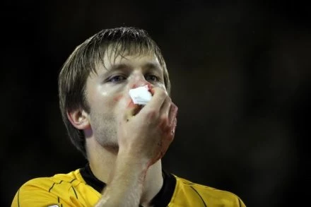 Jakub Błaszczykowski złamał nos podczas starcia z obrońcą Herthy Markiem Steinem