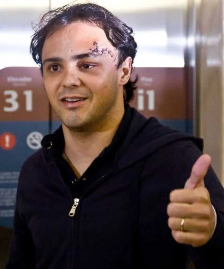 Felipe Massa pokazuje, że z jego zdrowiem jest już znacznie lepiej Felipe Massa pokazuje, że z jego zdrowiem jest już znacznie lepiej