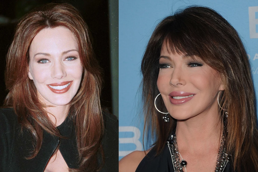Hunter Tylo. Gdy 20 lat temu dołączyła do obsady „Mody na sukces” była jej prawdziwą ozdobą. Dziś twarz Hunter (50) zmieniona wypełniaczami, botoksem, może już tylko budzić przerażenie. Hunter Tylo. Gdy 20 lat temu dołączyła do obsady „Mody na sukces” była jej prawdziwą ozdobą. Dziś twarz Hunter (50) zmieniona wypełniaczami, botoksem, może już tylko budzić przerażenie.