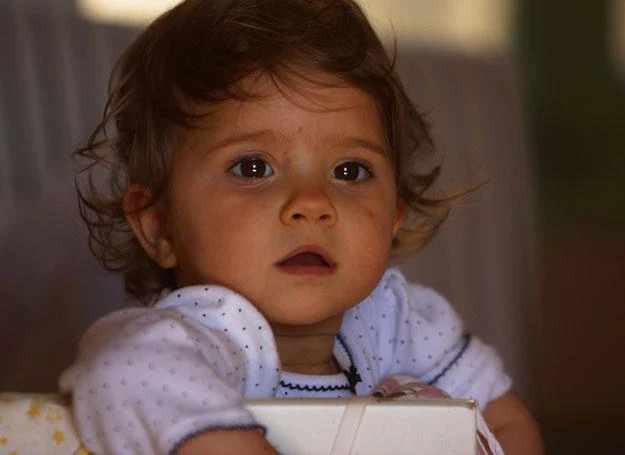 Ospa wietrzna jest jedną z typowo dziecięcych chorób zakaźnych Ospa wietrzna jest jedną z typowo dziecięcych chorób zakaźnych