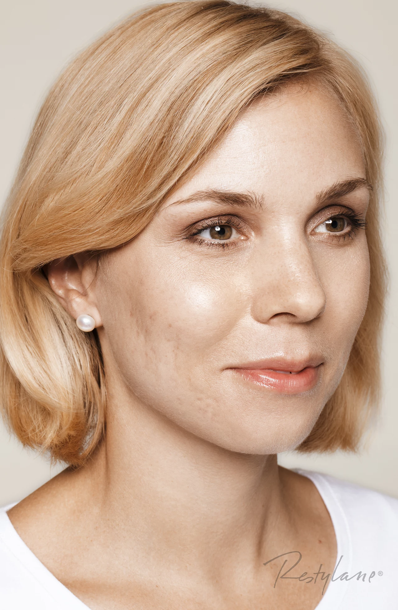 Zabieg na twarz - przed zabiegiem Restylane Skinboosters Zabieg na twarz - przed zabiegiem Restylane Skinboosters