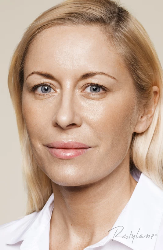 Zabieg na twarz - po zabiegu Restylane Skinboosters Zabieg na twarz - po zabiegu Restylane Skinboosters