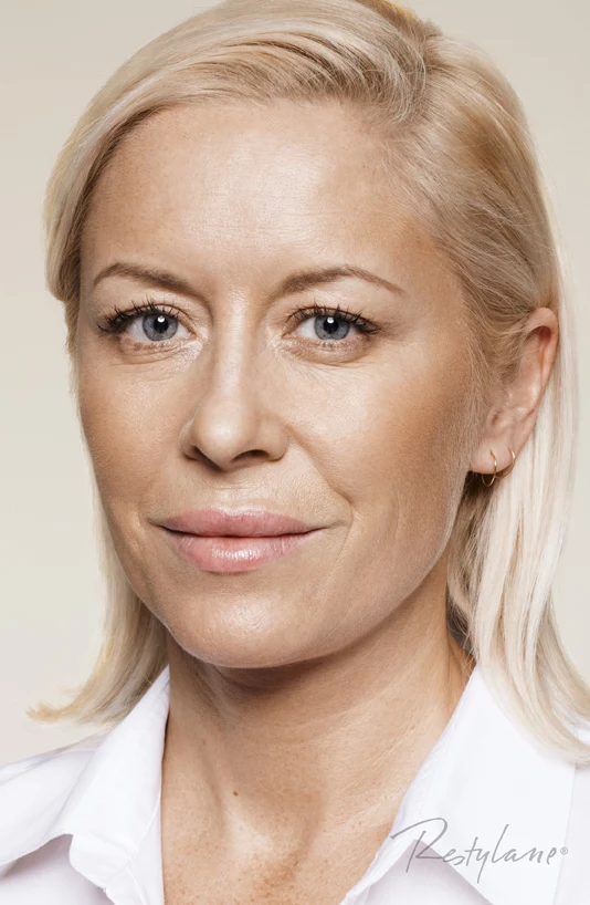 Zabieg na twarz - przed zabiegiem Restylane Skinboosters Zabieg na twarz - przed zabiegiem Restylane Skinboosters
