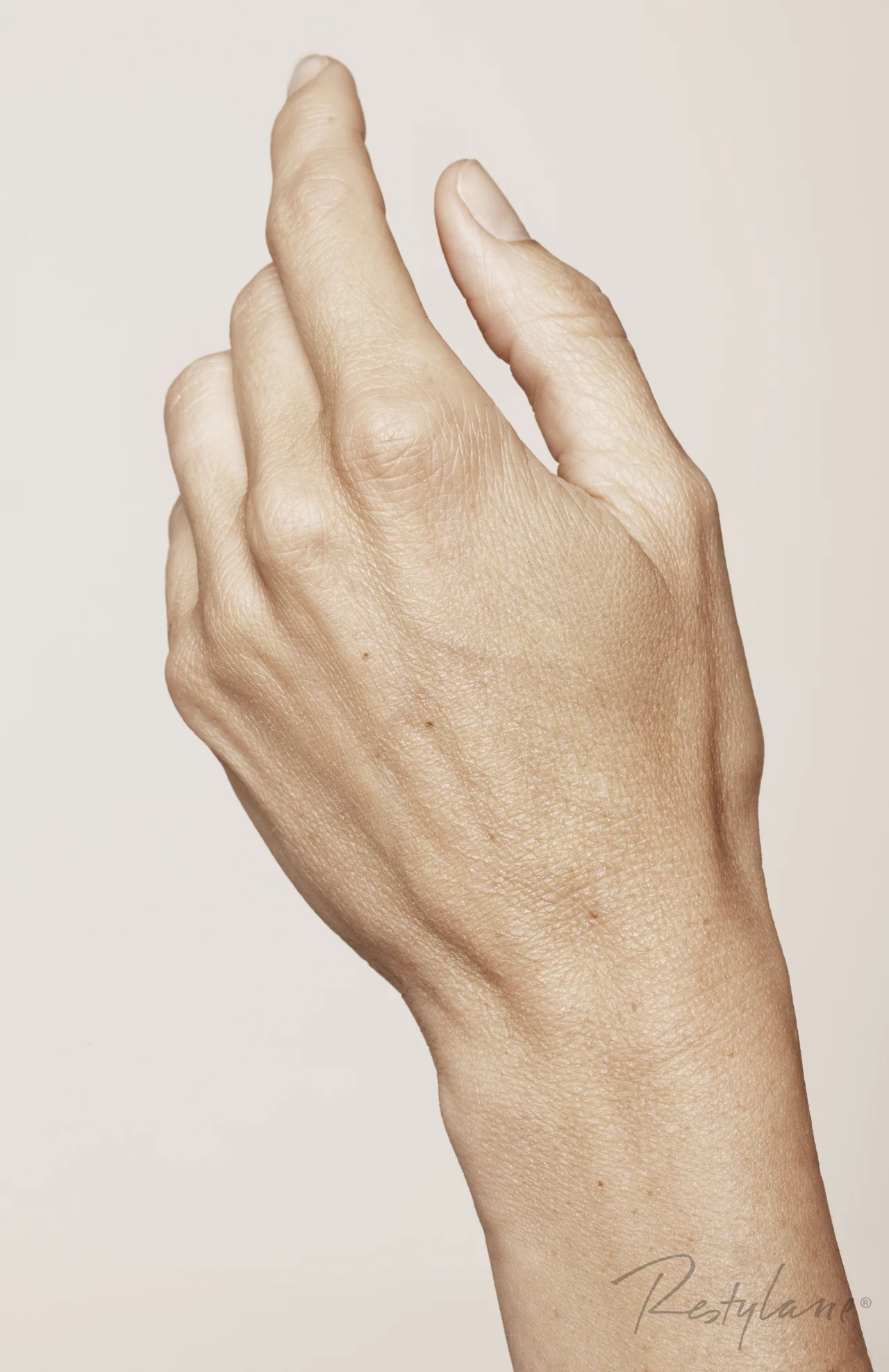 Zabieg na dłonie - przed zabiegiem Restylane Skinboosters Zabieg na dłonie - przed zabiegiem Restylane Skinboosters