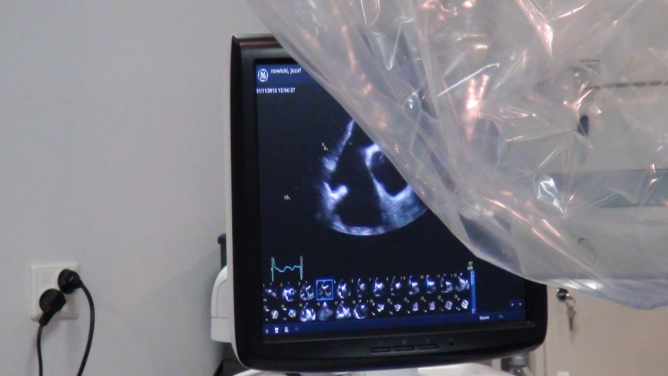 Zabieg przeprowadził zespół kardiologów pod przewodnictwem Profesora Dariusza Dudka z Pracowni Hemodynamiki i Angiografii Szpitala Uniwersyteckiego w Krakowie 