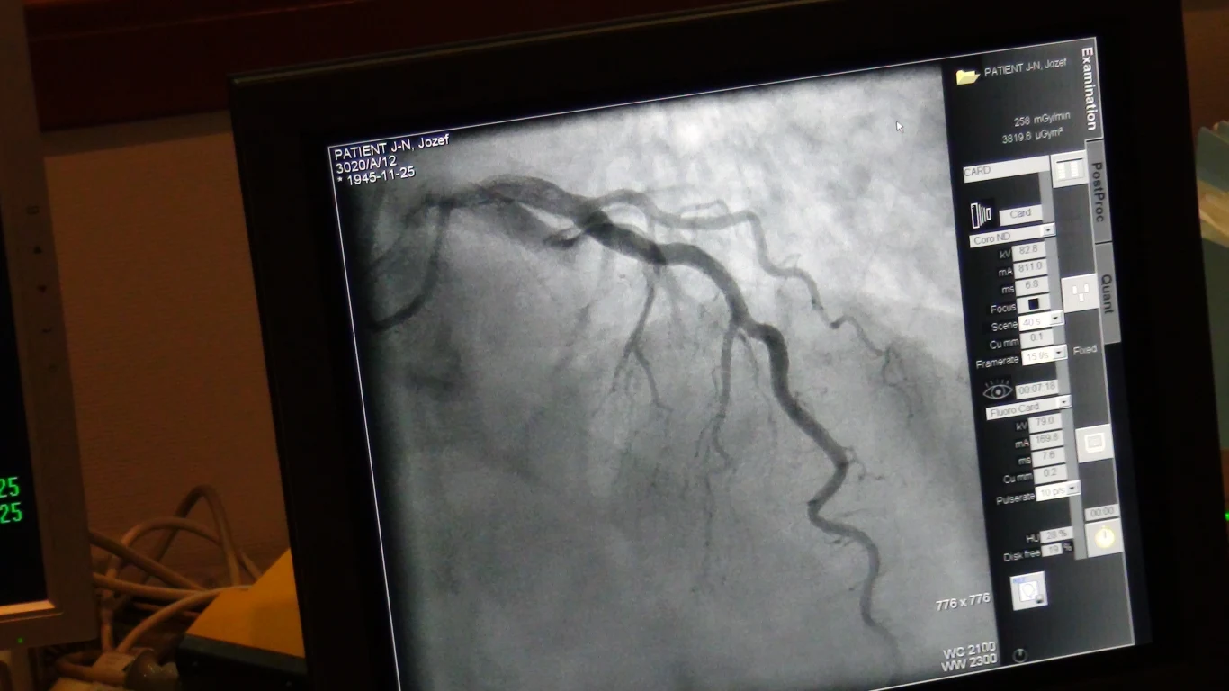 Zabieg przeprowadził zespół kardiologów pod przewodnictwem Profesora Dariusza Dudka z Pracowni Hemodynamiki i Angiografii Szpitala Uniwersyteckiego w Krakowie 