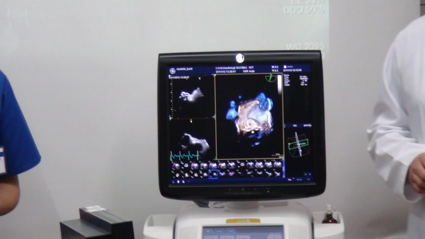 Zabieg przeprowadził zespół kardiologów pod przewodnictwem Profesora Dariusza Dudka z Pracowni Hemodynamiki i Angiografii Szpitala Uniwersyteckiego w Krakowie 