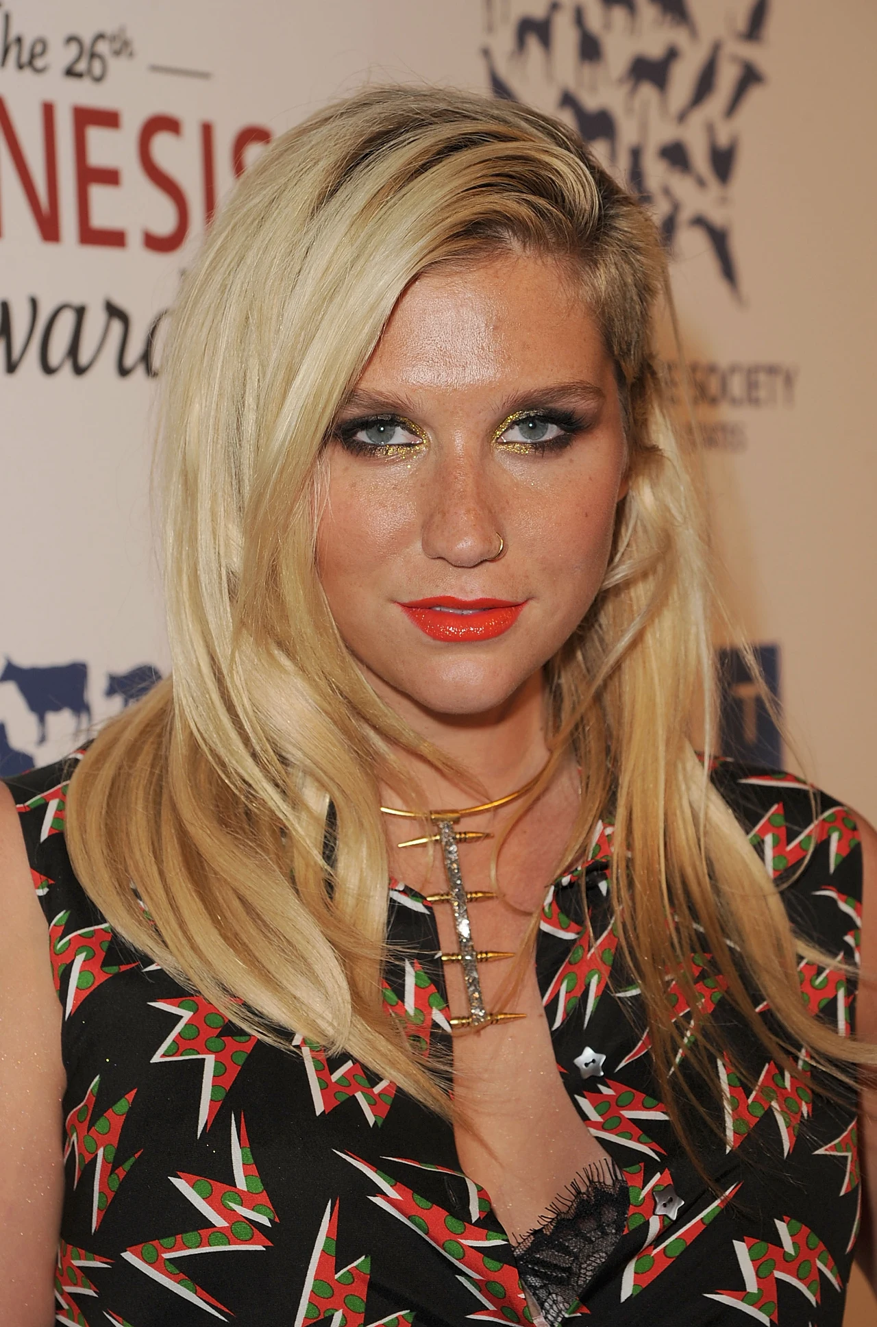 Ke$ha