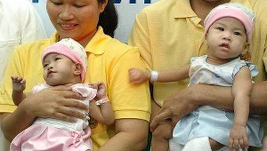 Tajlandia: Pionierska operacja rozdzielenia bliźniąt