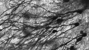 Neurony ludzkiego hipokampa (c) MethoxyRoxy, Creative Commons