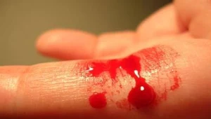 Jak umiemy walczyć z bólem