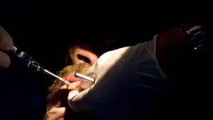 Tracąc zęby tracimy rozum