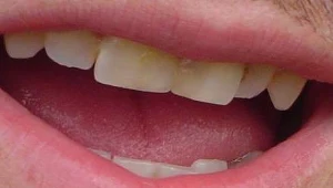 ? Eggybird, Creative Commons