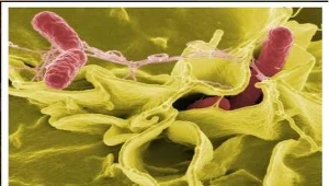 Salmonella chroni przed zapaleniem płuc