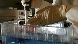 Abirateron ma podarować chorym na raka prostaty kilka dodatkowych lat życia