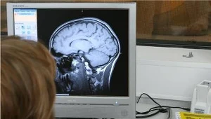 Schizofrenia - ewolucyjny wypadek przy pracy?