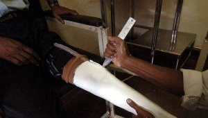 Złamane serce boli bardziej niż złamana noga