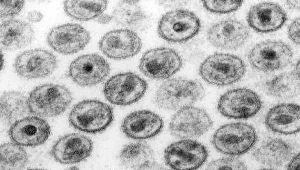 Zdjęcie wirusa HIV