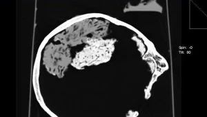 Skan odnalezionej czaszki