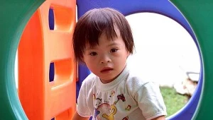 Niektóre objawy zespołu Downa u dziecka będzie można leczyć w łonie matki